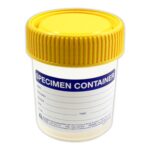YELLOW TOP SPECIMEN JAR